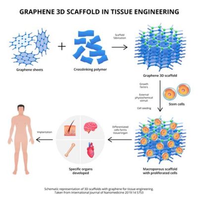  Graphene - Nanocząstki rewolucjonizujące przyszłość medycyny i inżynierii tkankowej!