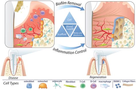  Hydroksyapatyt: Biomateriał przyszłości w medycynie regeneracyjnej i implantach dentylnych!